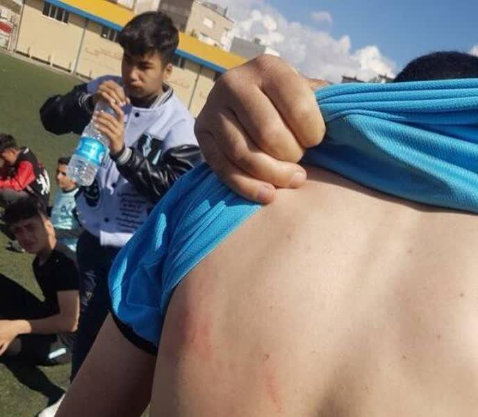 قمهکشی کنار مدرسه در گلشهر؛ زنگ خطر خشونت نوجوانان به صدا درآمد
